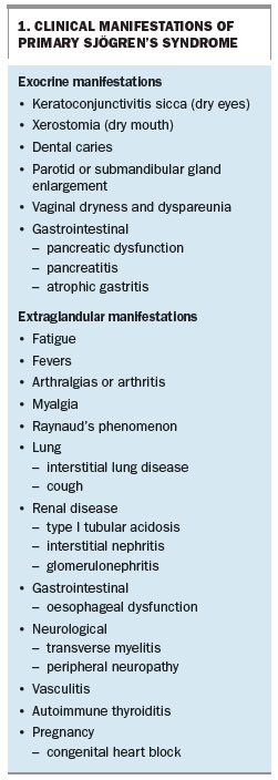 Diagnosis And Management Of Primary Sjögren’s Syndrome | Medicine Today