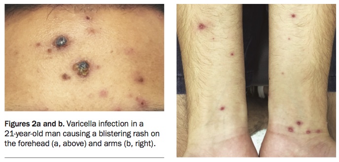 How would you diagnose this patient's 3-year rash?