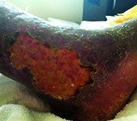 Fig 1a Fig 1a