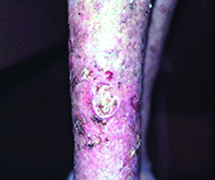 Fig 3 Fig 3