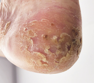 Fig 1b.
