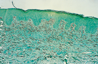 Fig 2. Mast cells Fig 2. Mast cells