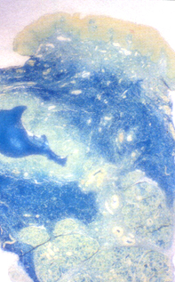 Fig 2. Sialomucin Fig 2. Sialomucin