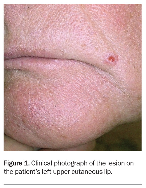 Figure 1. Figure 1.