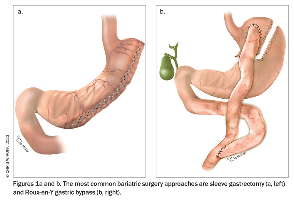 Figure 1. Figure 1.