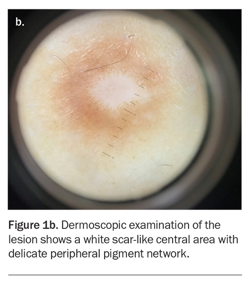 Figure 1b. Figure 1b.
