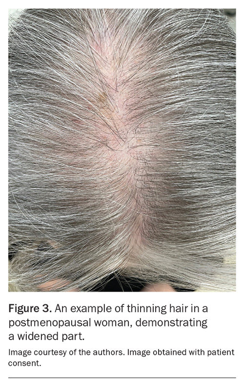 Figure 3. Figure 3.