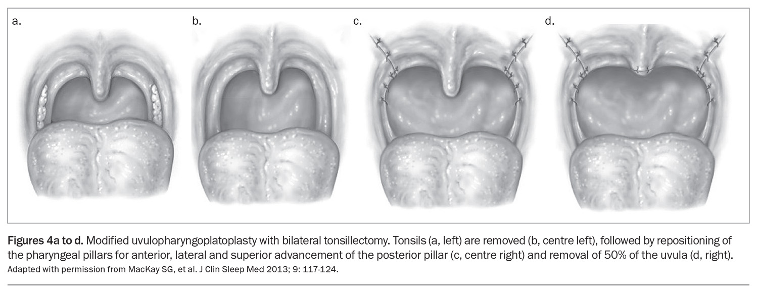 Figure 4a and b. Figure 4a and b.