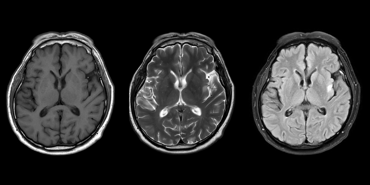 Radiological imaging/shutterstock.com