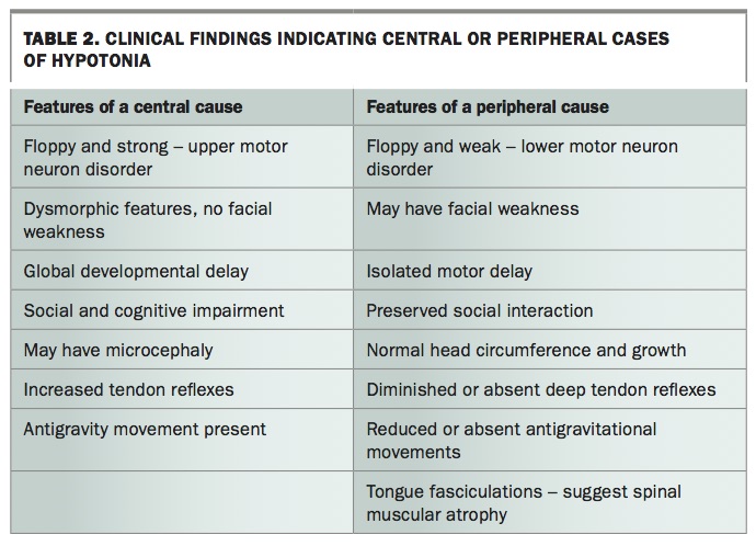 The floppy baby: a diagnostic challenge | Medicine Today