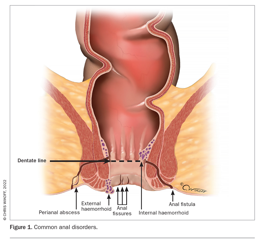 Anal cancer - Symptoms and causes - Mayo Clinic