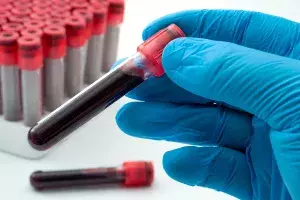 Test tubes of blood