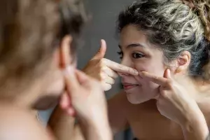 Acne scarring: why it occurs and what can be done