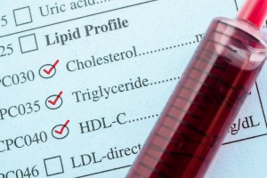  Hypertriglyceridaemia: causes, assessment and management of cardiovascular risk