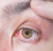 © VCHALUP/STOCK.ADOBE.COM