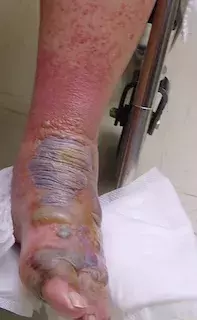 78-Year-Old Male With Pruritic Rash - The Doctor's Channel - Short Videos  for Doctors