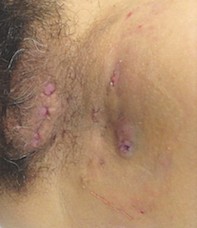 Fig 1.