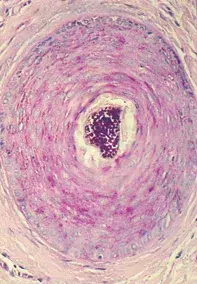 Fig 2. Scalp biopsy