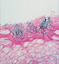 Fig 2. Stratum corneum