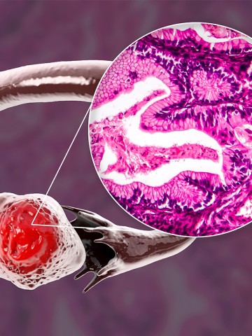© DR_MICROBE/STOCK.ADOBE.COM