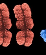 XXY chromosoMes (scanning electron micrograph). © BIOPHOTO ASSOCIATES/SPL