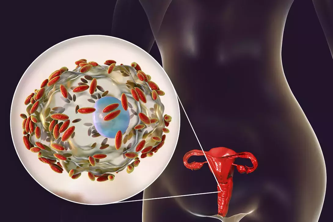 Photographs showing vaginal mucus discharges assessed according