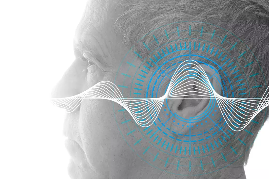 Hearing impairment is associated with cognitive decline, brain